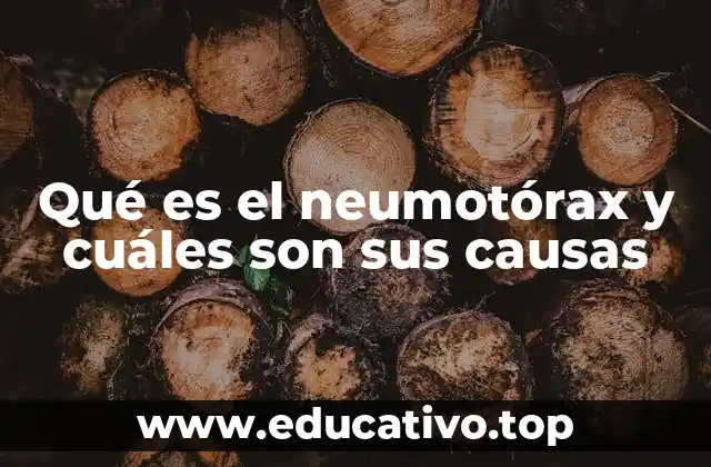 Qué es el neumotórax y cuáles son sus causas