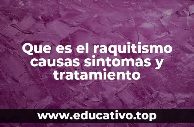 Que es el raquitismo causas sintomas y tratamiento