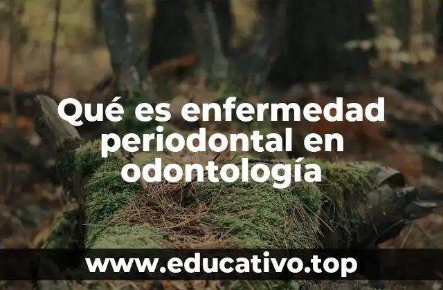 Qué es enfermedad periodontal en odontología
