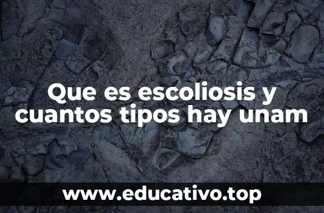 Que es escoliosis y cuantos tipos hay unam