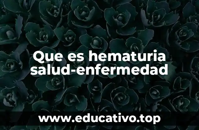 Que es hematuria salud-enfermedad