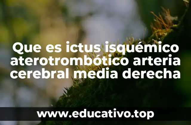 Que es ictus isquémico aterotrombótico arteria cerebral media derecha