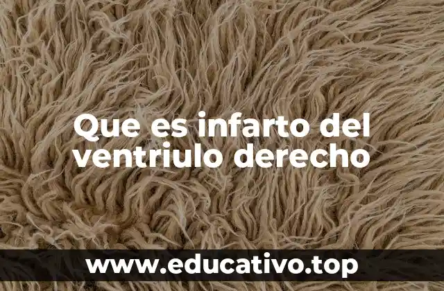 Que es infarto del ventriulo derecho