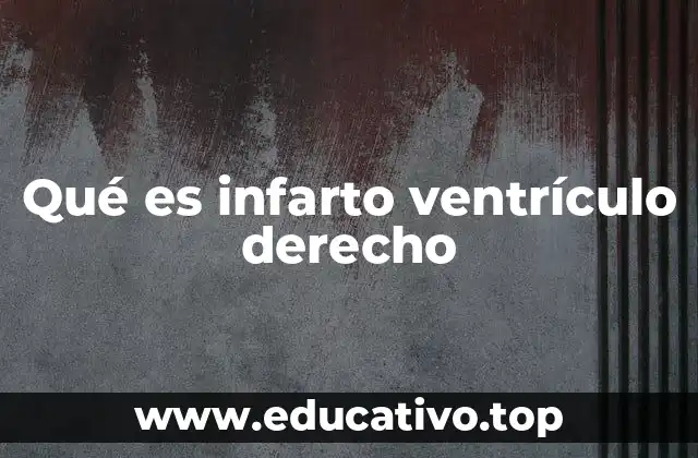 Qué es infarto ventrículo derecho