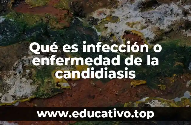 Qué es infección o enfermedad de la candidiasis