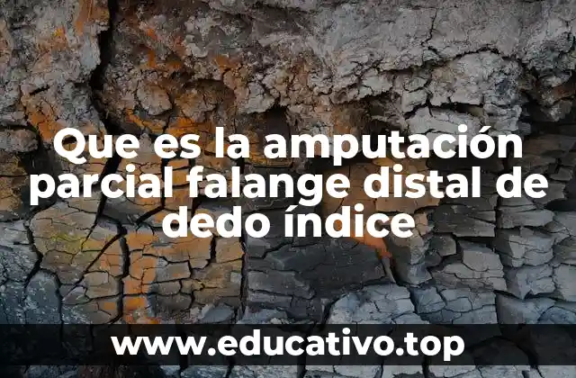 Que es la amputación parcial falange distal de dedo índice