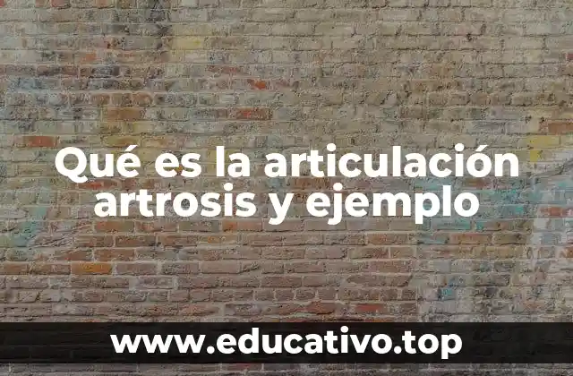 Qué es la articulación artrosis y ejemplo