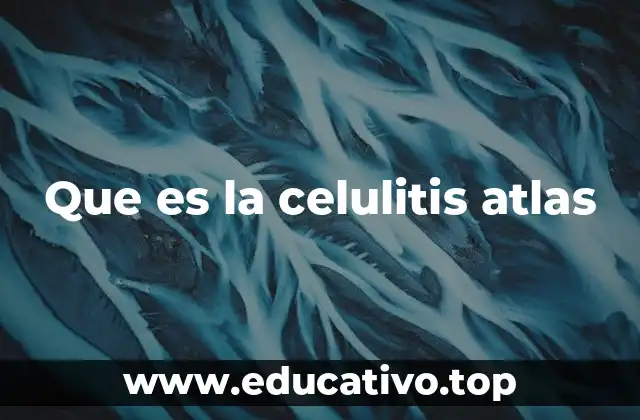 La importancia de los atlas médicos en el diagnóstico de la celulitis