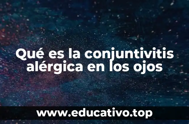 Qué es la conjuntivitis alérgica en los ojos