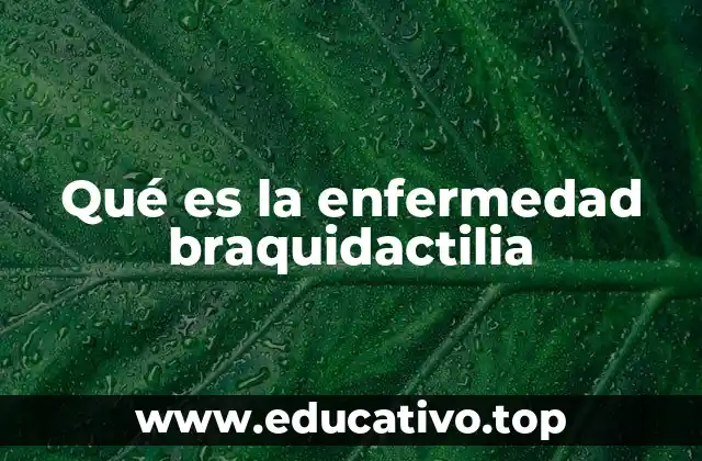 Qué es la enfermedad braquidactilia