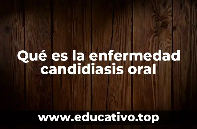 Qué es la enfermedad candidiasis oral