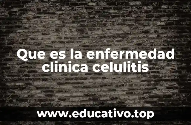 Que es la enfermedad clinica celulitis