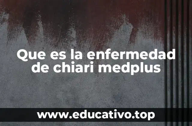 Que es la enfermedad de chiari medplus