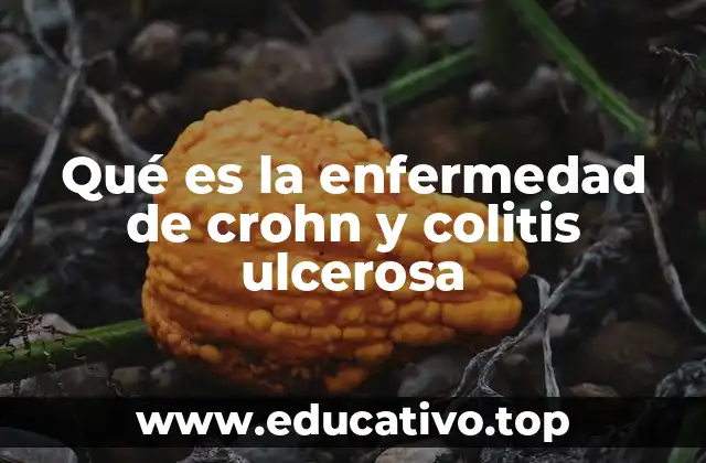 Qué es la enfermedad de crohn y colitis ulcerosa