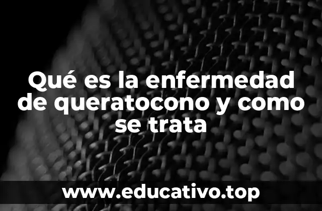 Qué es la enfermedad de queratocono y como se trata