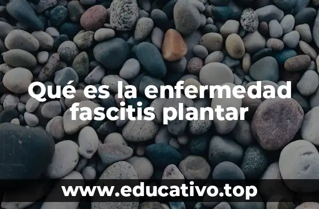 Qué es la enfermedad fascitis plantar