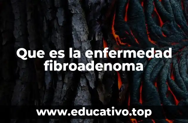 Que es la enfermedad fibroadenoma