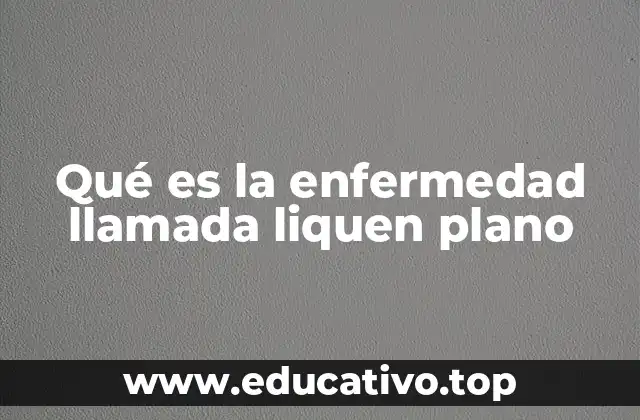 Qué es la enfermedad llamada liquen plano