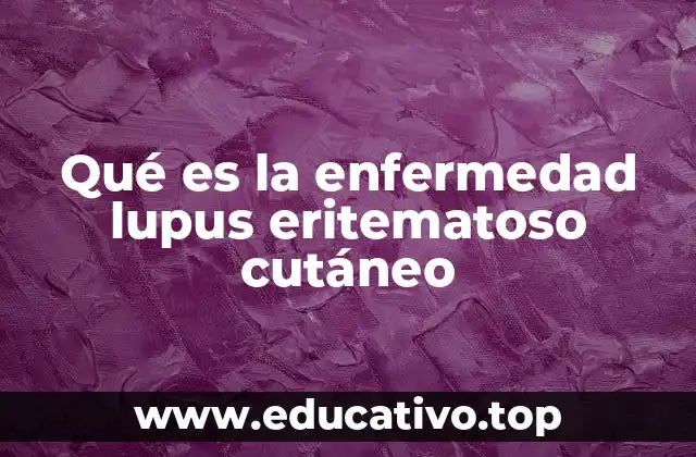 Qué es la enfermedad lupus eritematoso cutáneo