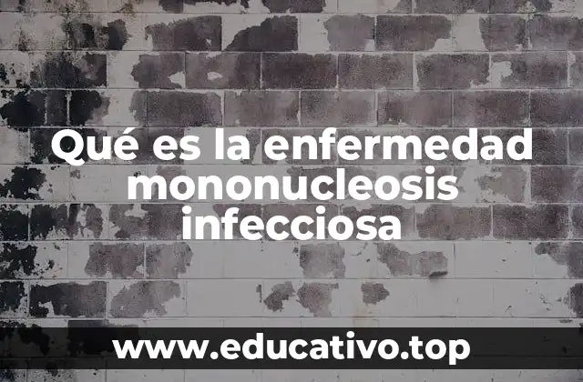 Qué es la enfermedad mononucleosis infecciosa