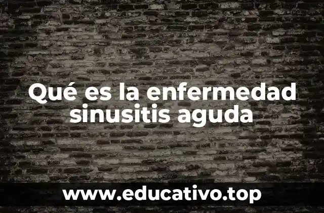 Qué es la enfermedad sinusitis aguda