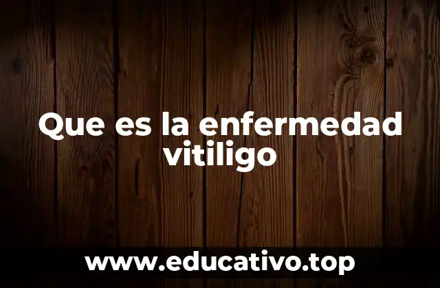 Que es la enfermedad vitiligo