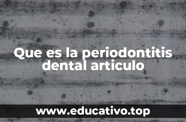 Que es la periodontitis dental articulo