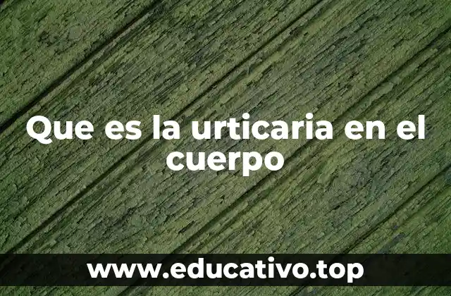 Que es la urticaria en el cuerpo