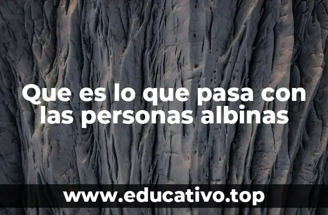 Que es lo que pasa con las personas albinas