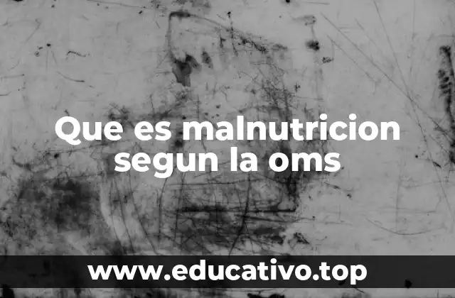 Que es malnutricion segun la oms