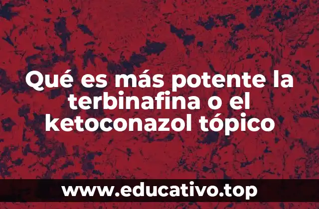Qué es más potente la terbinafina o el ketoconazol tópico