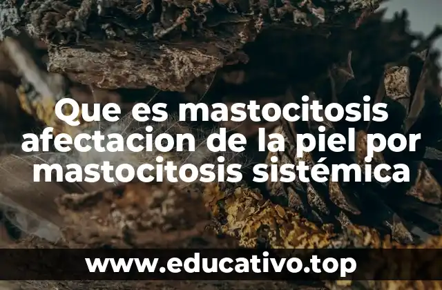 Que es mastocitosis afectacion de la piel por mastocitosis sistémica