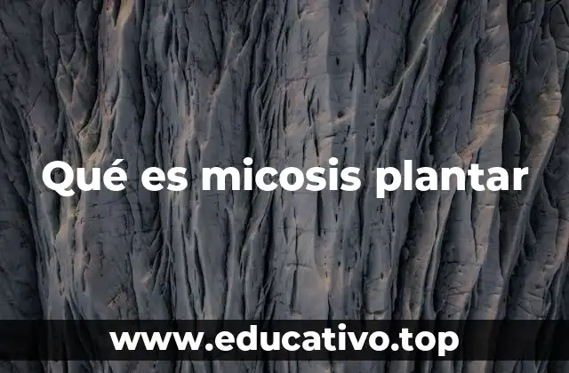 Qué es micosis plantar