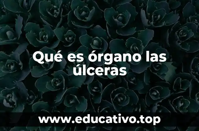 Qué es órgano las úlceras