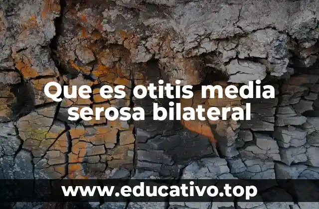Que es otitis media serosa bilateral