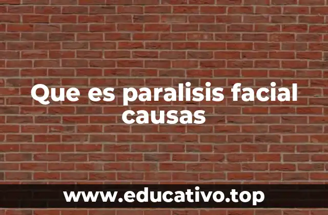 Que es paralisis facial causas