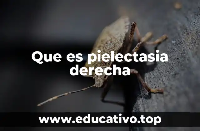 Cómo se detecta la pielectasia en el riñón derecho