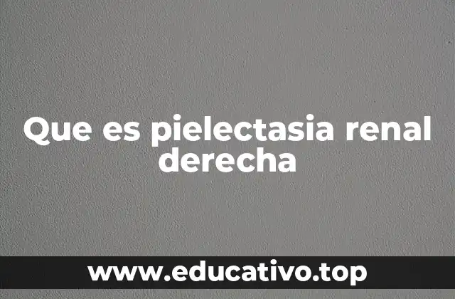 Que es pielectasia renal derecha