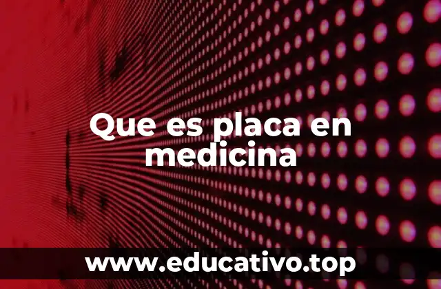 Que es placa en medicina