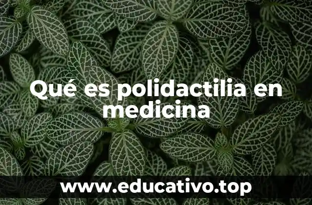 Qué es polidactilia en medicina