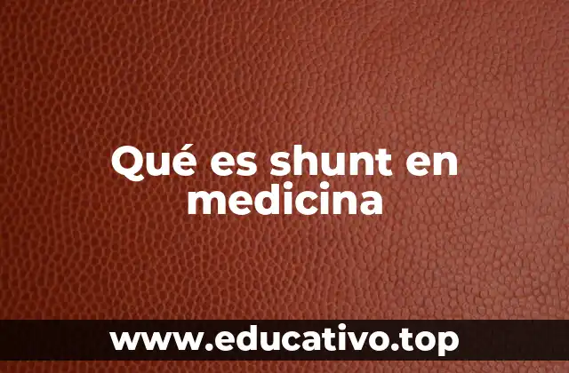 Qué es shunt en medicina