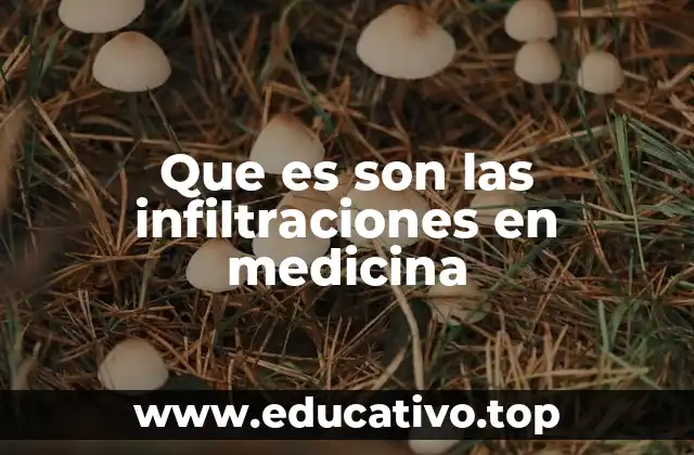 Que es son las infiltraciones en medicina
