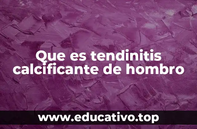 Que es tendinitis calcificante de hombro