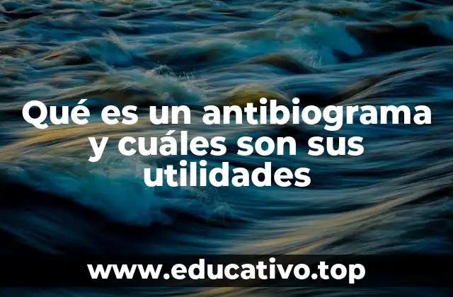 La importancia de los antibiogramas en la medicina moderna