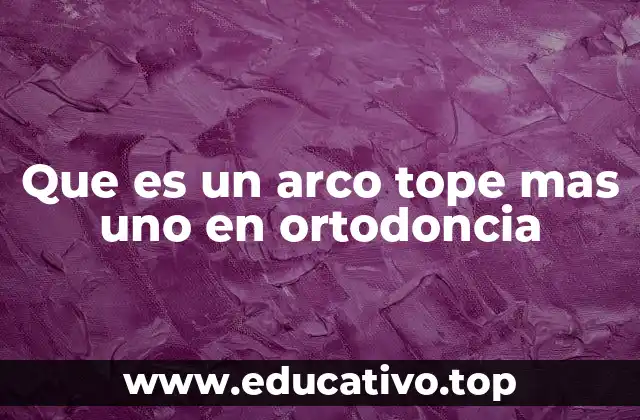 Que es un arco tope mas uno en ortodoncia