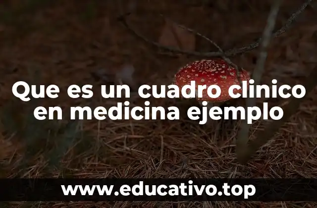 Que es un cuadro clinico en medicina ejemplo