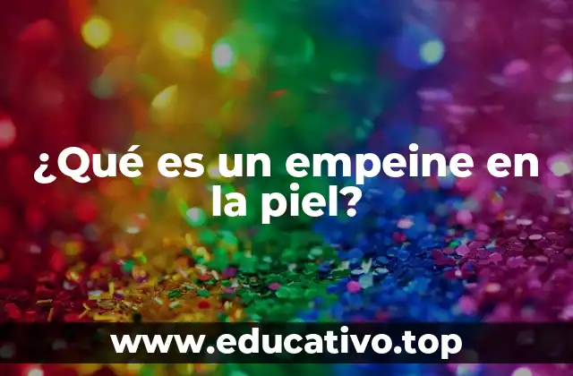 ¿Qué es un empeine en la piel?