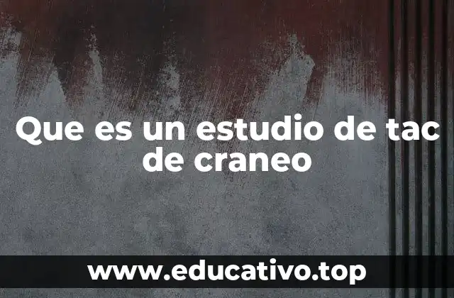 Que es un estudio de tac de craneo