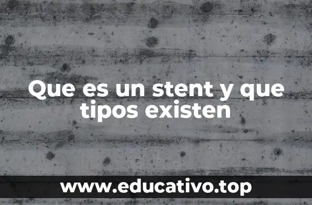 Que es un stent y que tipos existen