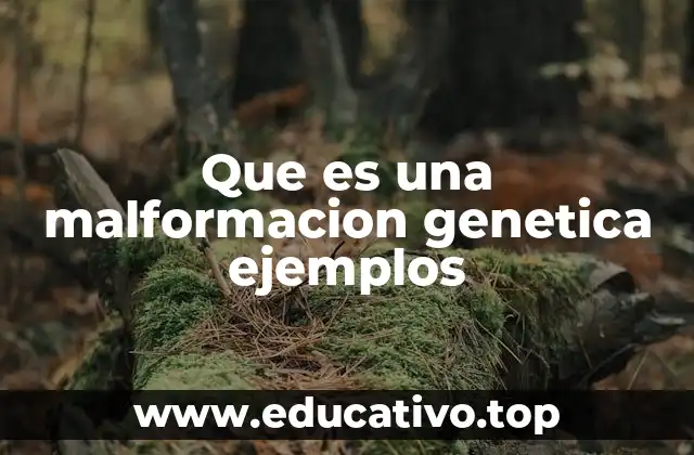 Que es una malformacion genetica ejemplos